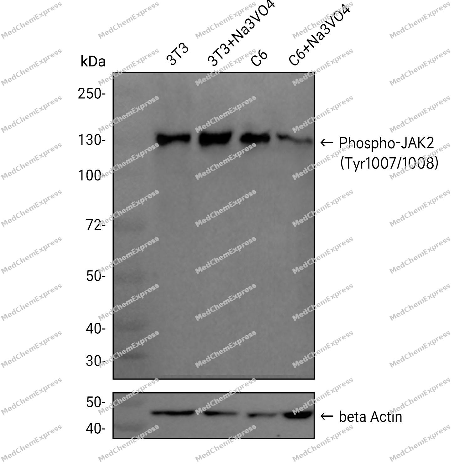 Phospho-JAK2 (Tyr1007/1008) Antibody (YA6449) 产品图片