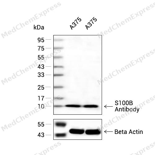 S100B Antibody 产品图片