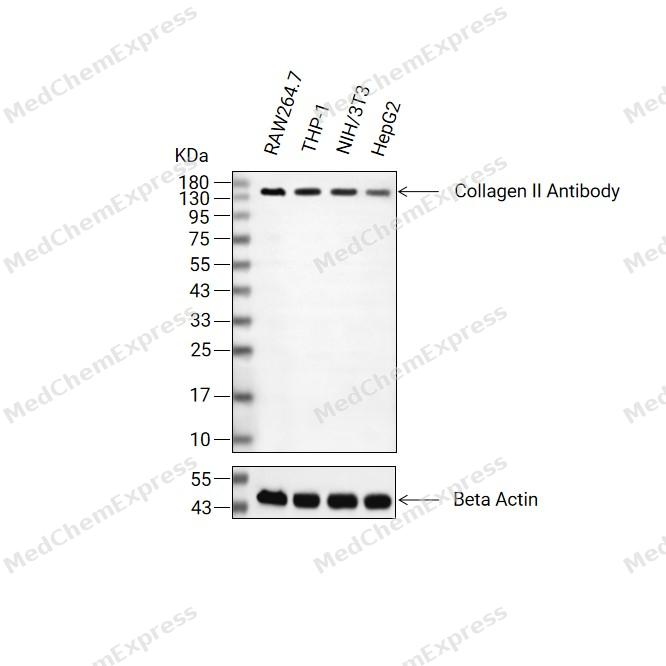 Collagen II Antibody(YA3550) 产品图片