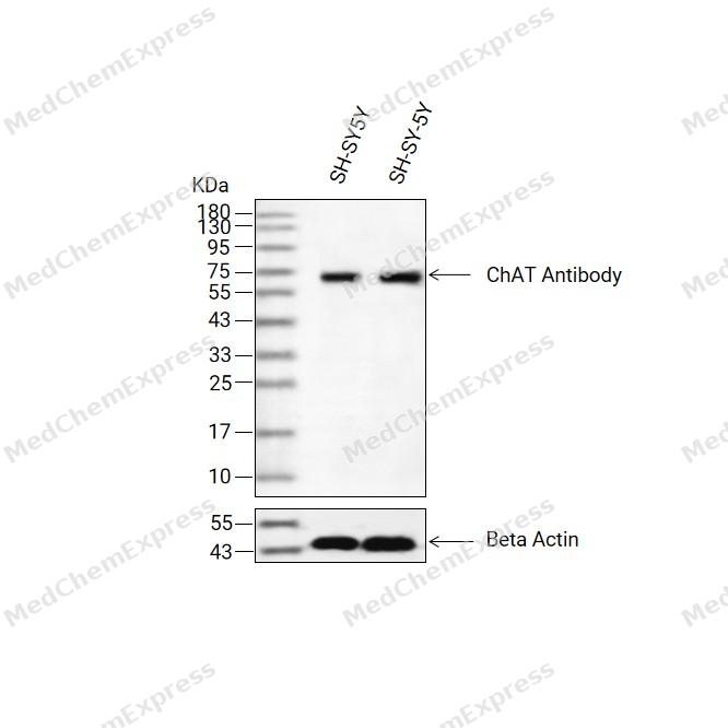 ChAT Antibody 产品图片