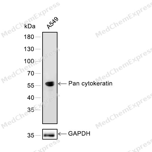 Pan Cytokeratin Antibody 产品图片