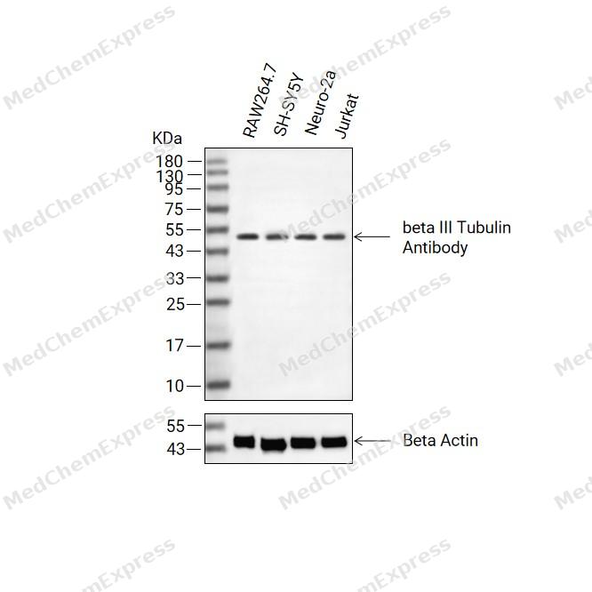 beta III Tubulin Antibody (YA4243) 产品图片