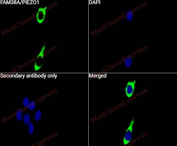 FAM38A/PIEZO1 Antibody (YA6568) 产品图片