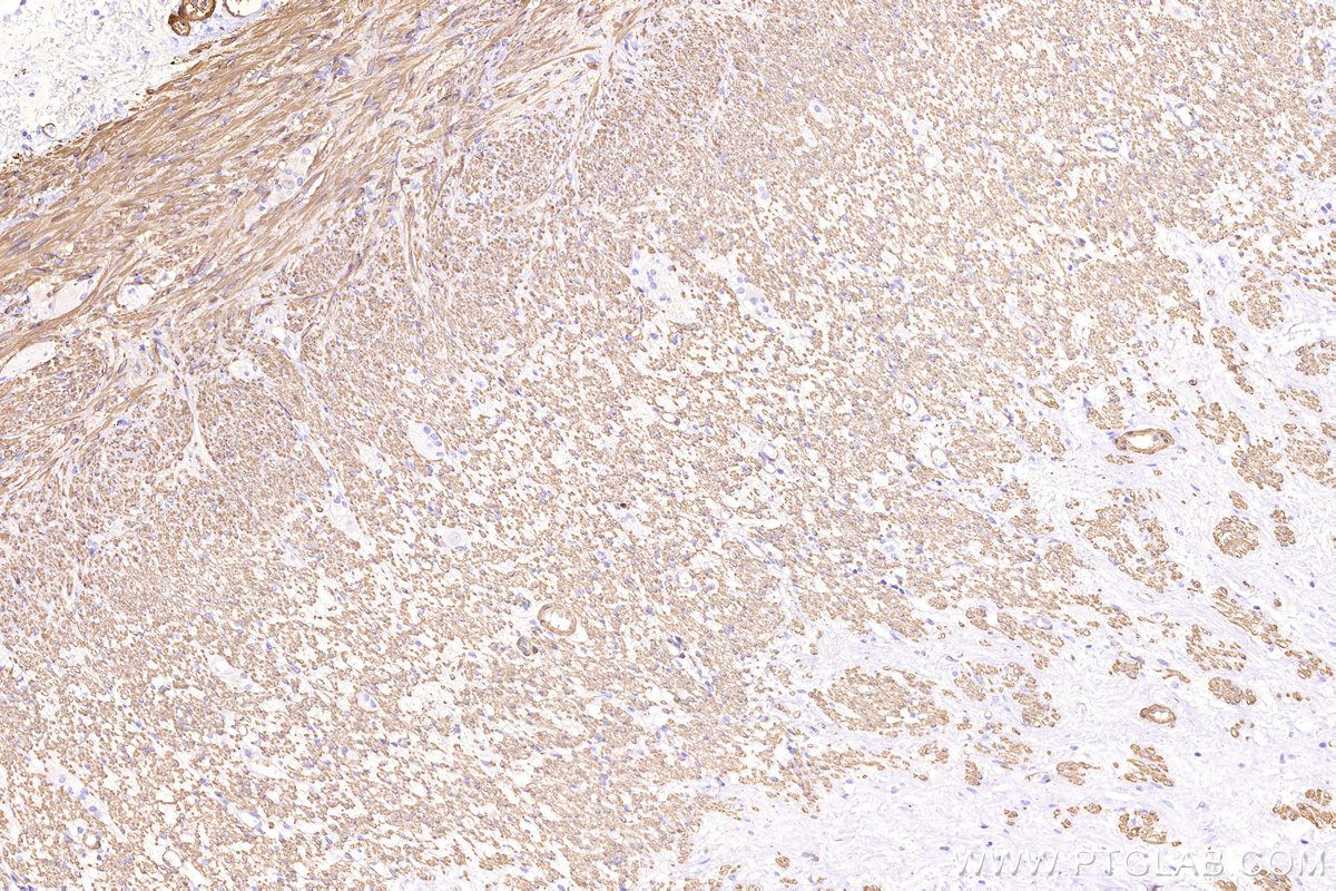 Multi-rAb® Biotin-Goat Anti-Rabbit Recombinant Secondary Antibody (H+L) (Cat No. RGAR009 ) 应用 WB, IHC, ELISA 偶联物 Biotin 反应性 Rabbit Host Goat From ¥230 产品图片