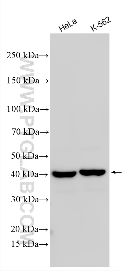 KD/KO Validated 1,475 Publications TDP-43 Polyclonal Antibody Reactivity: Human, Mouse, Rat, Zebrafish, Hamster, Pig and 产品图片