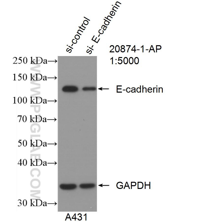 KD/KO Validated 1,826 Publications E-cadherin Polyclonal antibody Reactivity: Human, Mouse, Rat, Bovine, Pig, Zebrafish 产品图片