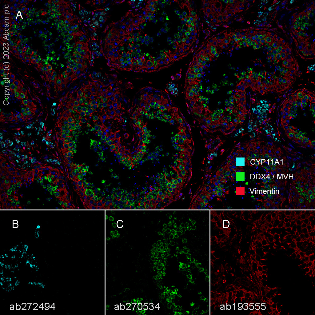 Anti-Vimentin 抗体 [EPR3776] - Cytoskeleton Marker 产品图片