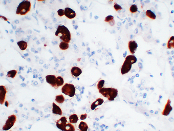 Adrenocorticotropin(ACTH) (ABT-ACTH) IHC kit 产品图片