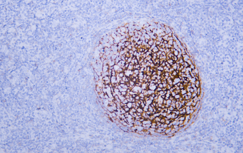 CD21 (ABT-CD21) IHC kit 产品图片