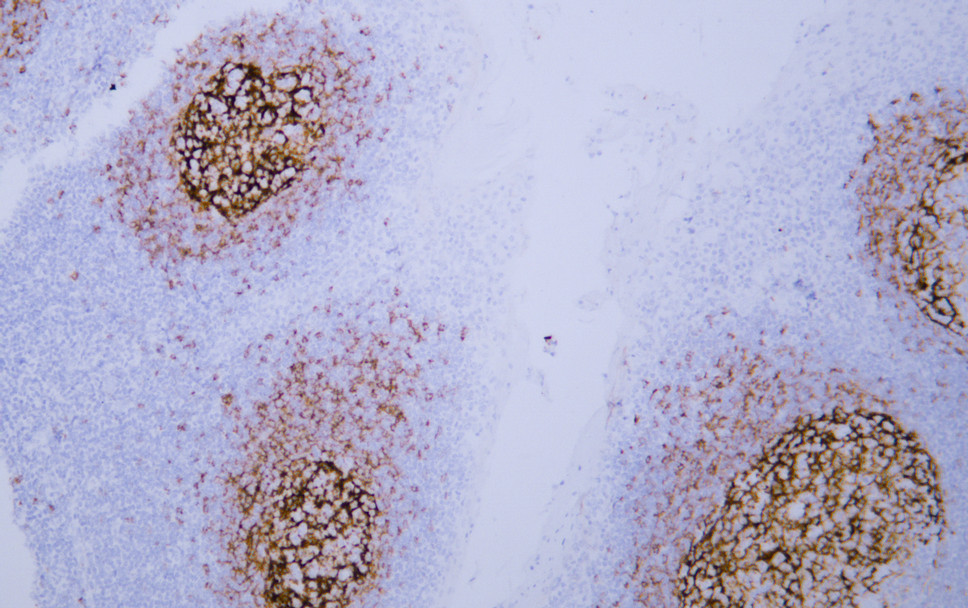 CD23 (ABT-CD23) IHC kit 产品图片
