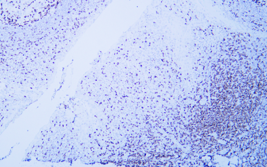 CD2 (ABT529) IHC kit 产品图片