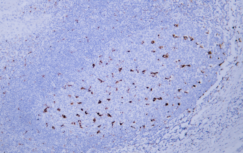 CD68 (ABT-CD68) IHC kit 产品图片
