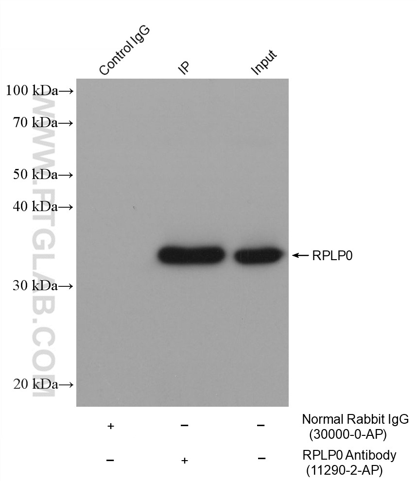 HRP-Goat Anti-Rabbit IgG Conformation Specific Recombinant Secondary Antibody (Cat No. RGAR301 ) 2引用文献 应用 IP-WB, WB, ELISA 偶联物 HRP 反应性 Rabbit Host Goa 产品图片