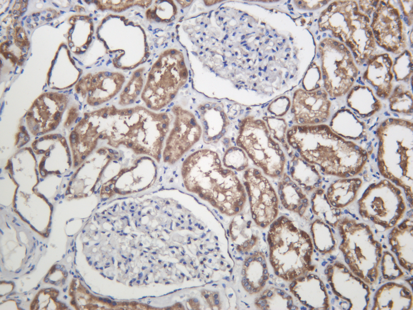 SDHA (ABT108) Rabbit mAb 产品图片