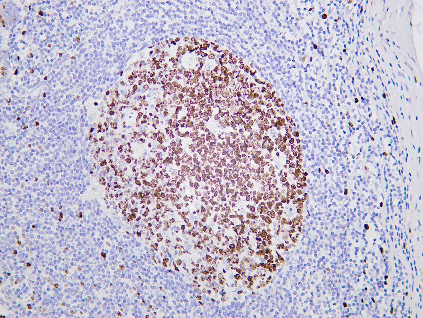 Ki67 (ABT137) Rabbit mAb 产品图片