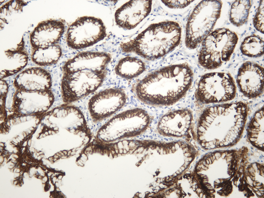 Carbonic Anhydrase 9 (ABT138) Rabbit mAb 产品图片