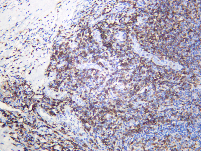 CD3 (ABT141) Rabbit mAb 产品图片