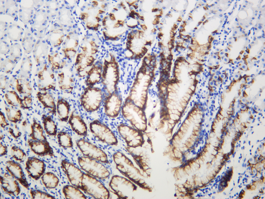 Mucin 5AC (ABT143) Rabbit mAb 产品图片