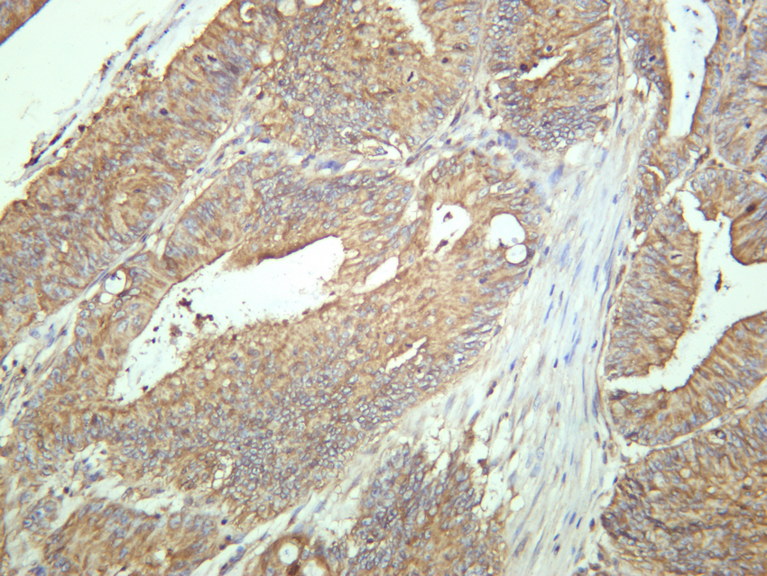 Rab11 (PT0823R) PT™ Rabbit mAb 产品图片